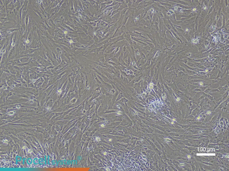 Mouse Uterine Fibroblast Complete Medium - 1