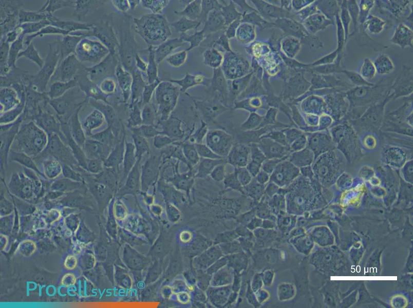Rat Endplate Chondrocytes - 5
