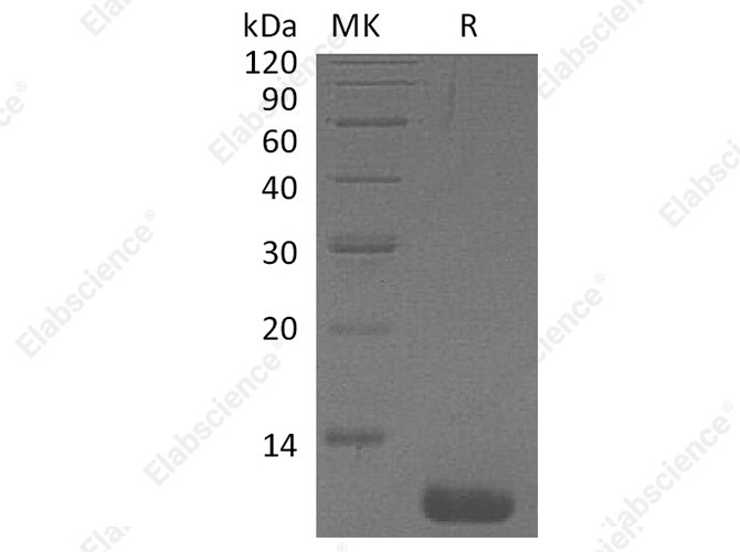 Recombinant Human CCL1/I-309 Protein - 1