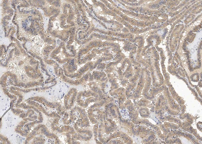 TROP2/TACSTD2 Monoclonal Antibody - 12