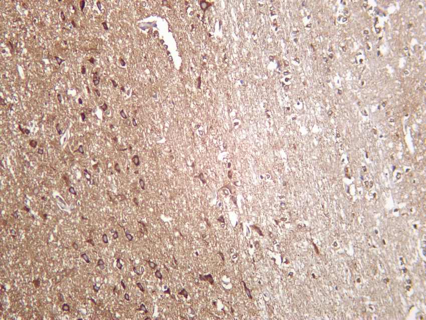 Recombinant DRP1 Monoclonal Antibody - 3