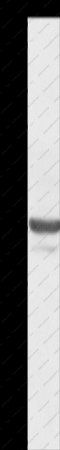 ANXA3 Polyclonal Antibody - 1