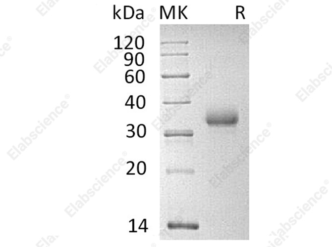Recombinant Human CD2 Protein (His Tag) - 1