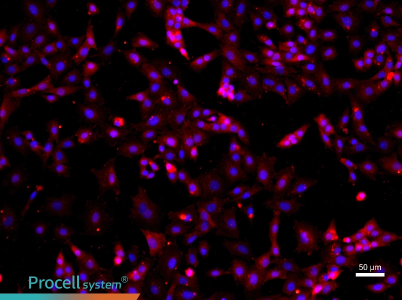 Mouse Ovarian Granulosa Cell Complete Medium - 1