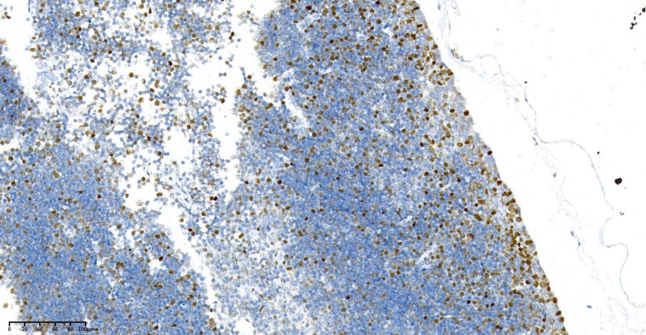 Recombinant PCNA Monoclonal Antibody - small - 3