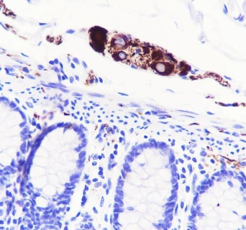 Recombinant Peripherin Monoclonal Antibody - small - 2