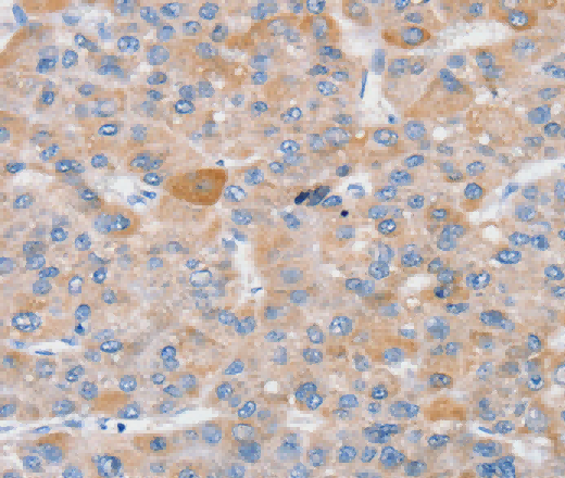 SLC25A13 Polyclonal Antibody - 3