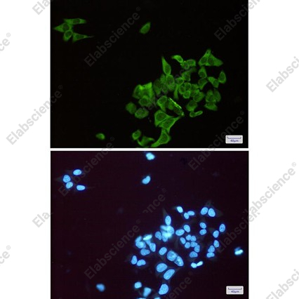 Recombinant ENO1 Monoclonal Antibody - 3