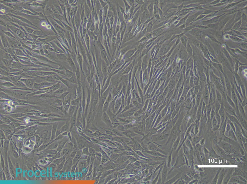 Human Intervertebral Disc Nucleus Pulposu (Primary cell immortalization) Cell Complete Medium - 1