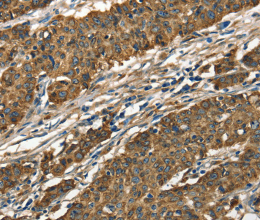 Cathepsin E Polyclonal Antibody - 2