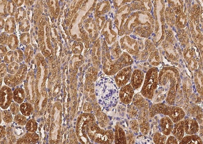 Recombinant Cathepsin B/CTSB Monoclonal Antibody - small - 2