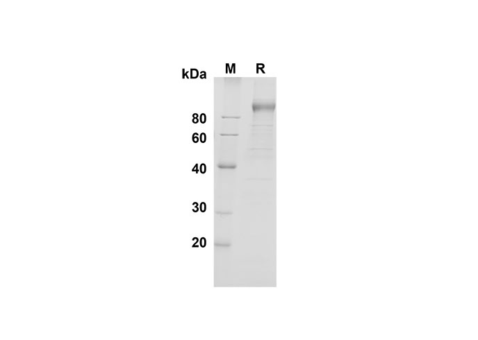 Recombinant Mouse IL-17A Protein(Halo Tag)-产品推荐-1