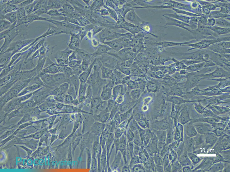 Human Uterine Fibroblast Complete Medium - 6