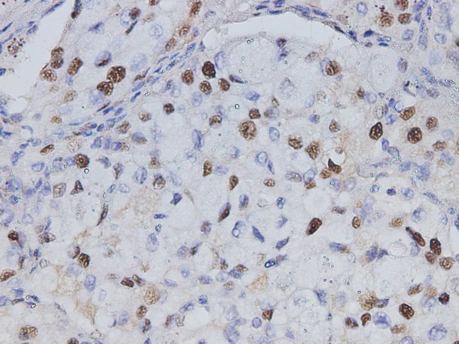 PCNA Monoclonal Antibody - 2