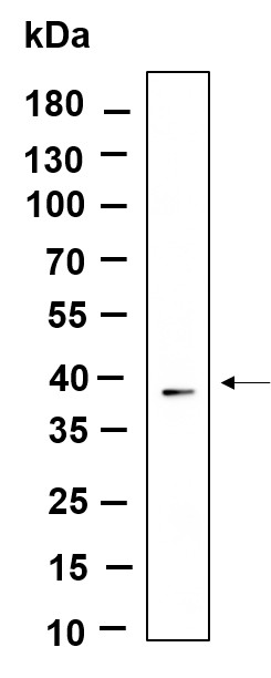 Recombinant Nucleophosmin Monoclonal Antibody-searchlist-1