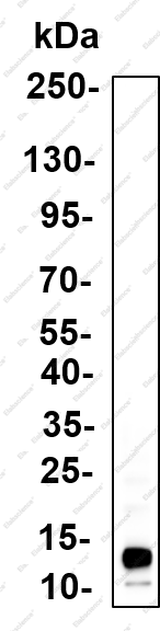 Recombinant pS2 Monoclonal Antibody - 2