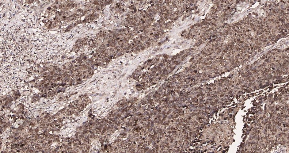 Recombinant Sumo 1 Monoclonal Antibody - 2