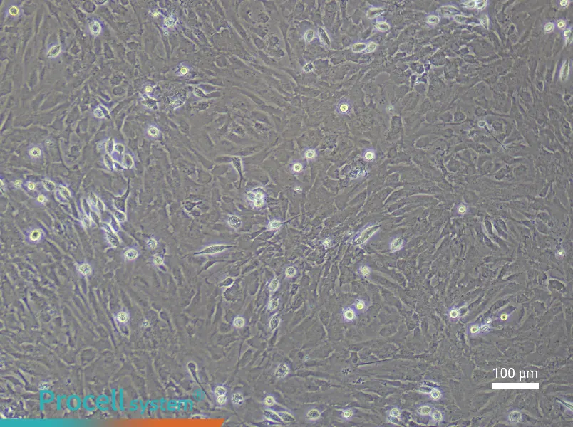Rat Cerebral Artery Smooth Muscle Cell Complete Medium - 1