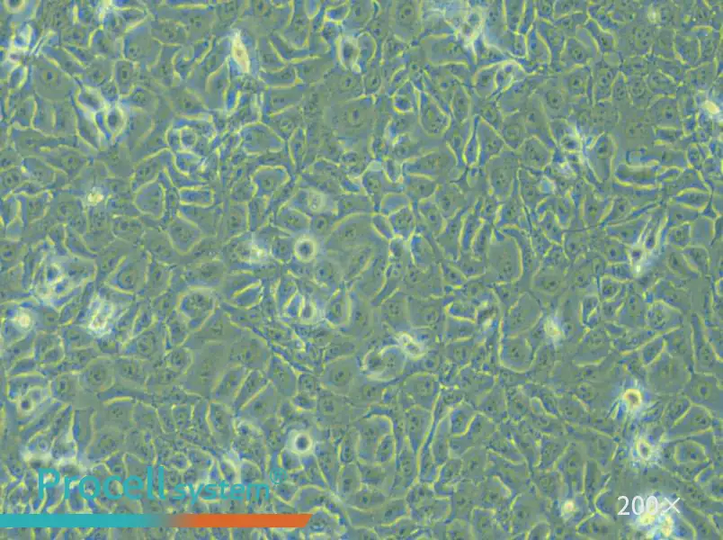 KYSE-450 Cell Complete Medium - small - 5