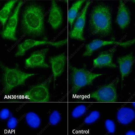 Recombinant UQCRFS1/RISP Monoclonal Antibody - 3