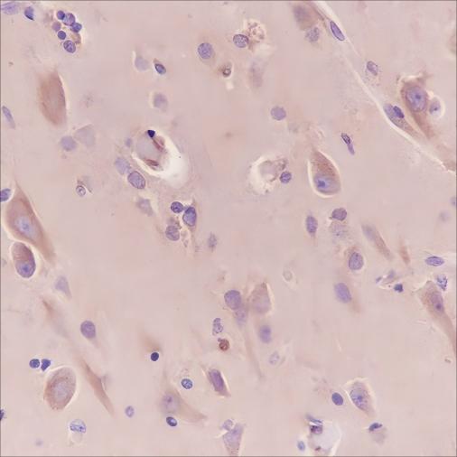 Recombinant BAP31 Monoclonal Antibody - 2