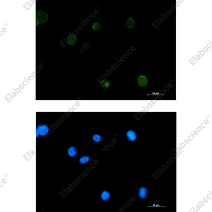 Recombinant Extracellular matrix protein 1 Monoclonal Antibody - 2