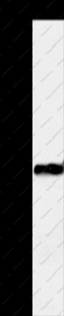 OTC Polyclonal Antibody - 1