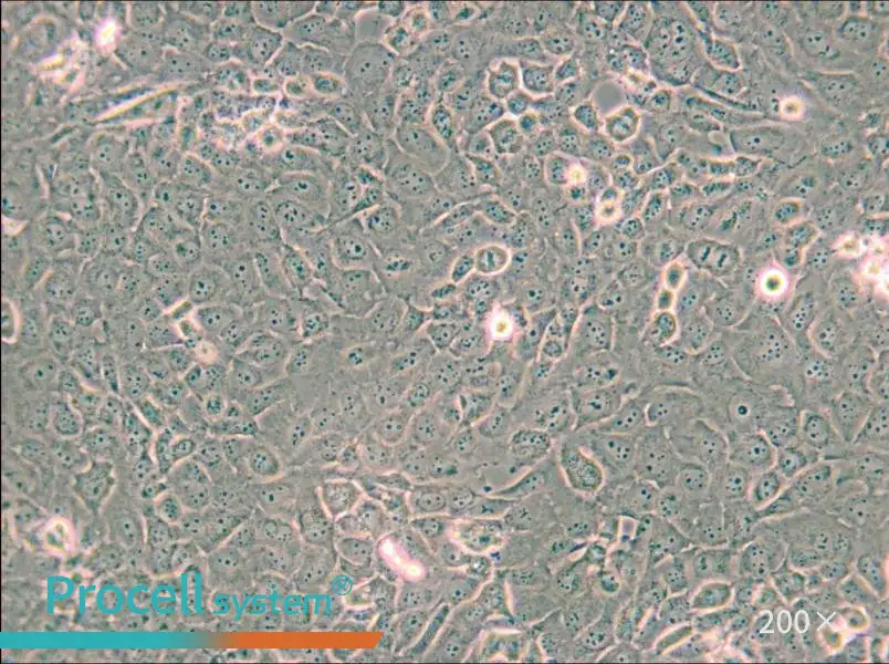 B-CPAP [BC-PAP; BCPAP] Cell Complete Medium - small - 4