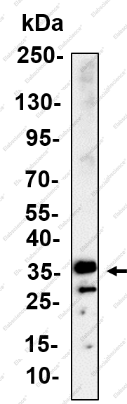 Recombinant AMPKγ1 Monoclonal Antibody - 1