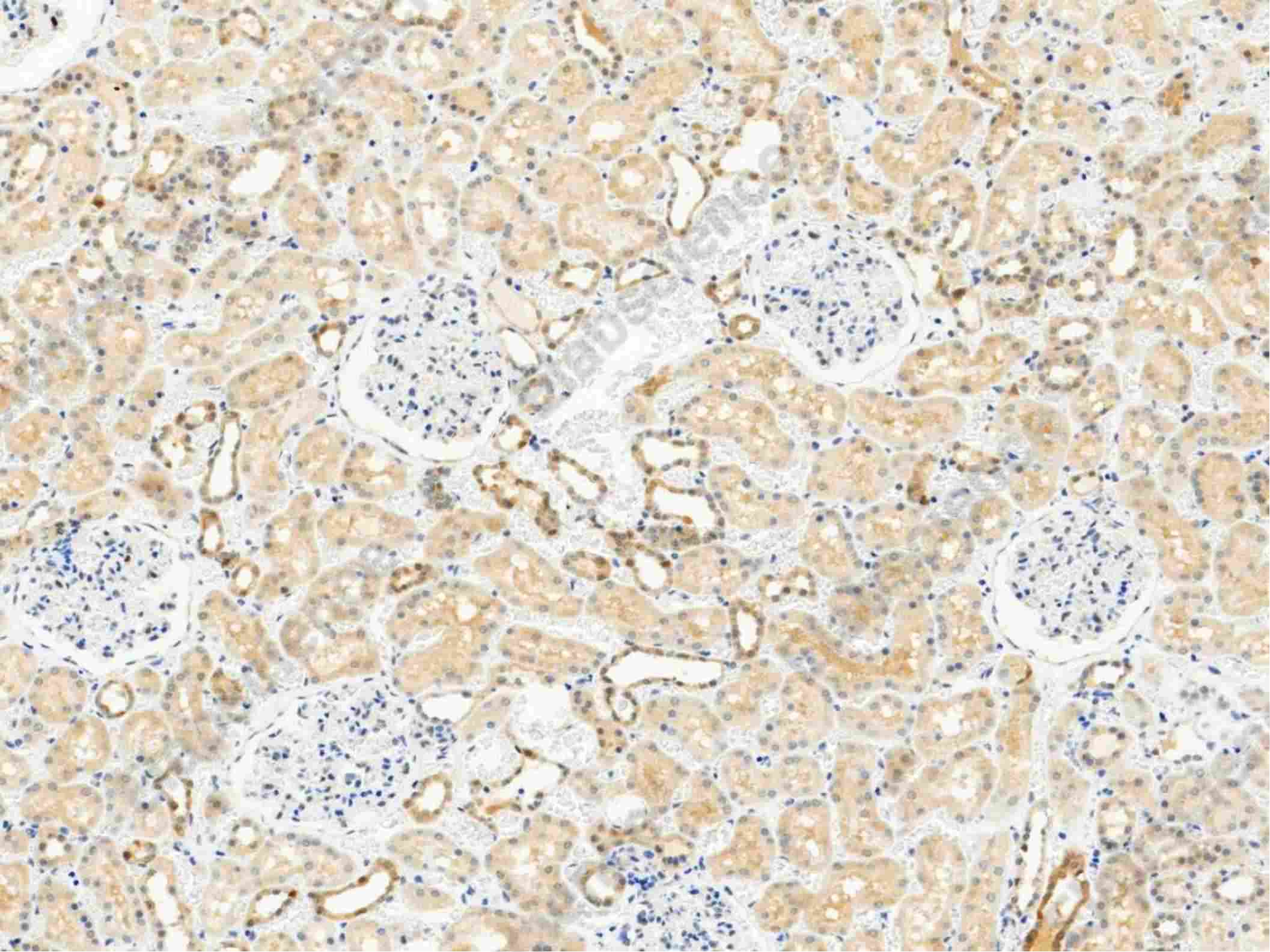 Recombinant RRM2B/P53R2 Monoclonal Antibody - 1