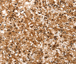 RBM5 Polyclonal Antibody - 2