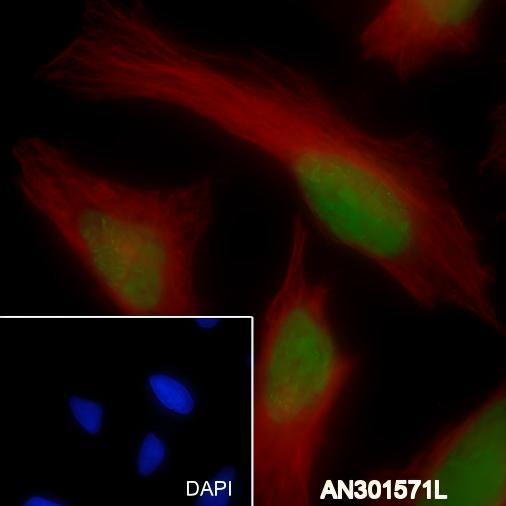 Recombinant JunB Monoclonal Antibody - 3