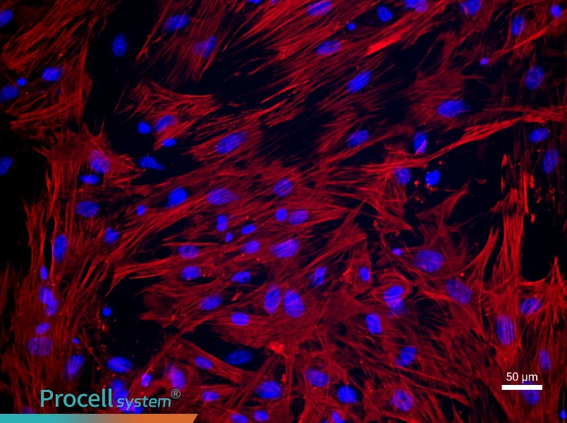 Mouse Uterine Smooth Muscle Cell Complete Medium - 1