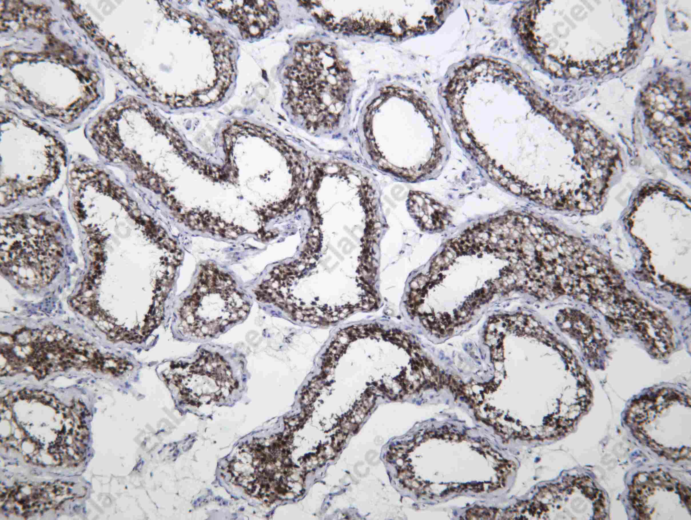 Recombinant DYL1 Monoclonal Antibody - 1