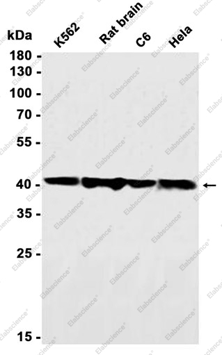 Recombinant Creatine kinase B type Monoclonal Antibody - 1