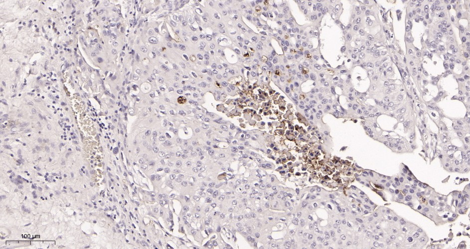 Recombinant CD133 Monoclonal Antibody - small - 2