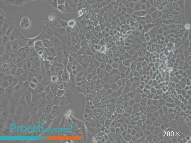 MKN74 Cell Complete Medium - 5