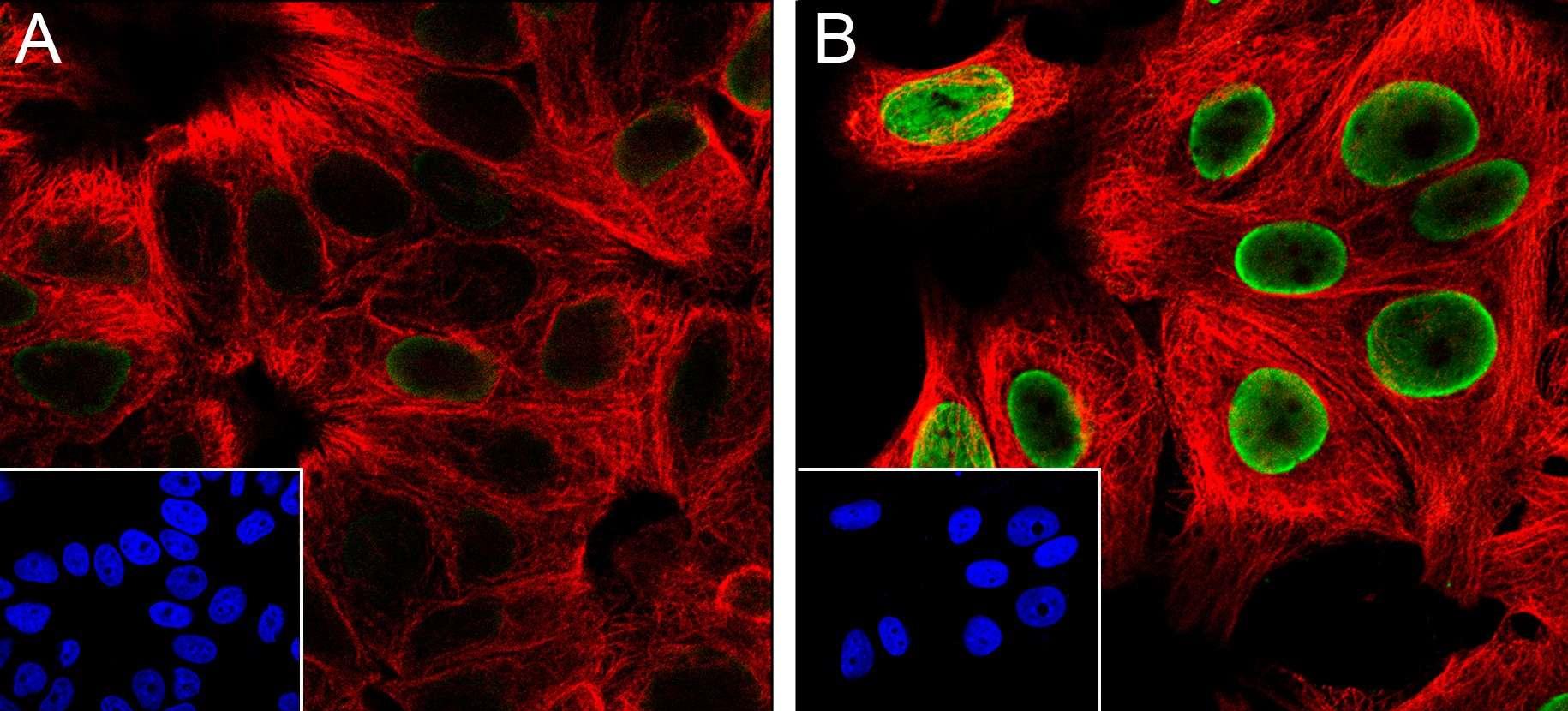 Recombinant Histone H2B (Acetyl Lys46) Monoclonal Antibody-searchlist-3
