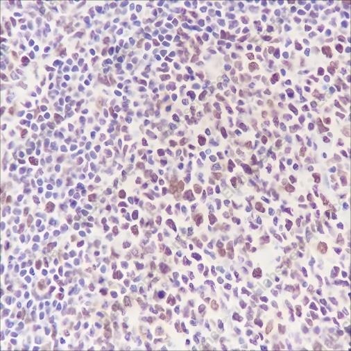 Recombinant DNMT1 Monoclonal Antibody - 3