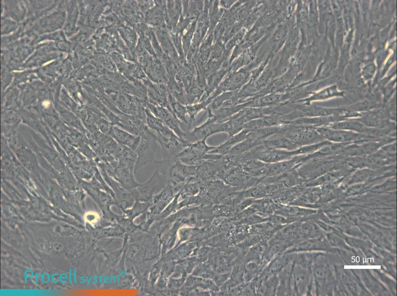 hTERT-HPNE - 5