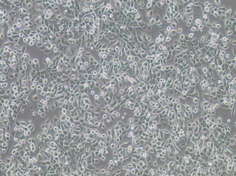 NPC/HK1 Cell Complete Medium - 2