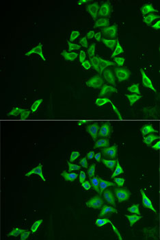 Immunofluorescence analysis of U2OS cells using INPP5J Polyclonal Antibody Blue: DAPI for nuclear staining.