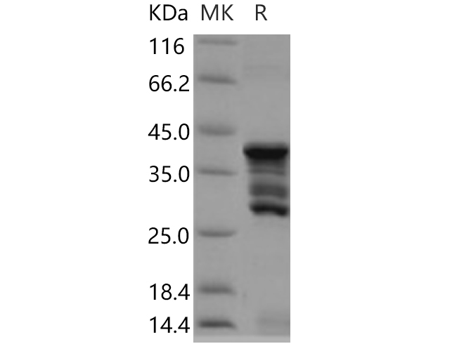 Recombinant Human CD247/CD3-ZETA Protein (GST Tag)-1