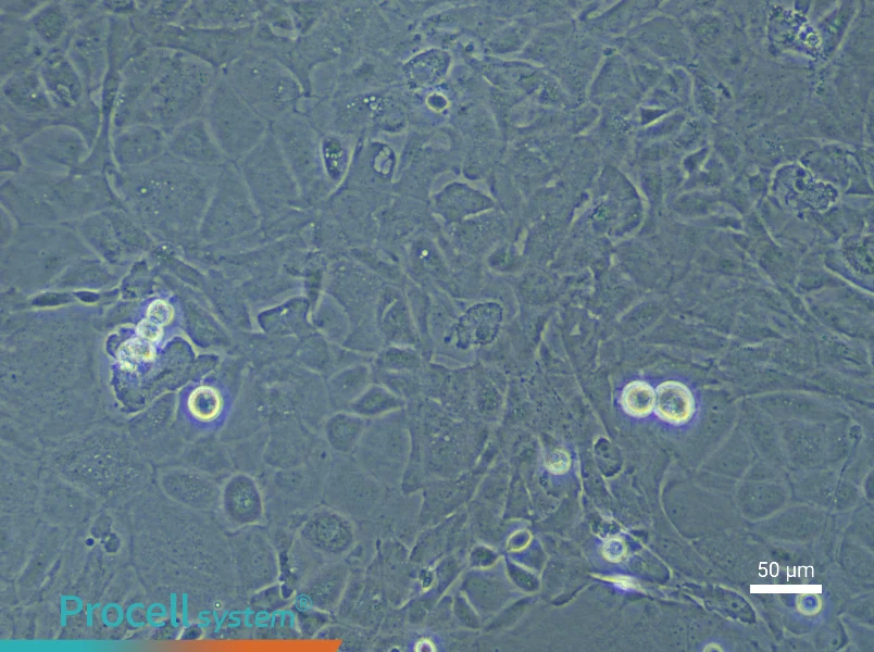 Rat Pulmonary Microvascular Endothelial Cell Complete Medium - 6
