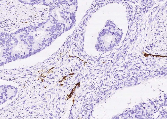 Recombinant Synaptophysin/SYP Monoclonal Antibody - small - 3