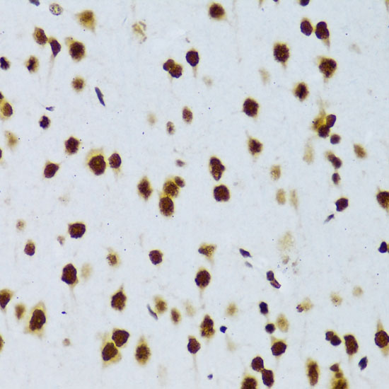 Immunohistochemistry of paraffin-embedded rat brain using FUS Polyclonal Antibody at dilution of 1:100 (40x lens).Perform microwave antigen retrieval with 10 mM PBS buffer pH 7.2 before commencing with IHC staining protocol.