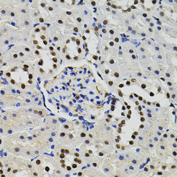 Immunohistochemistry of paraffin-embedded rat kidney using GTF2I Polyclonal antibody (40x lens).Perform microwave antigen retrieval with 10 mM PBS buffer pH 7.2 before commencing with IHC staining protocol.
