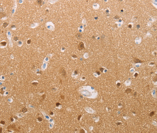Immunohistochemistry of paraffin-embedded Human brain using PFN2 Polyclonal Antibody at dilution of 1:30