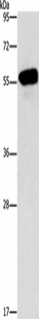 Western Blot analysis of Mouse eyes tissue using CDK19 Polyclonal Antibody at dilution of 1:950