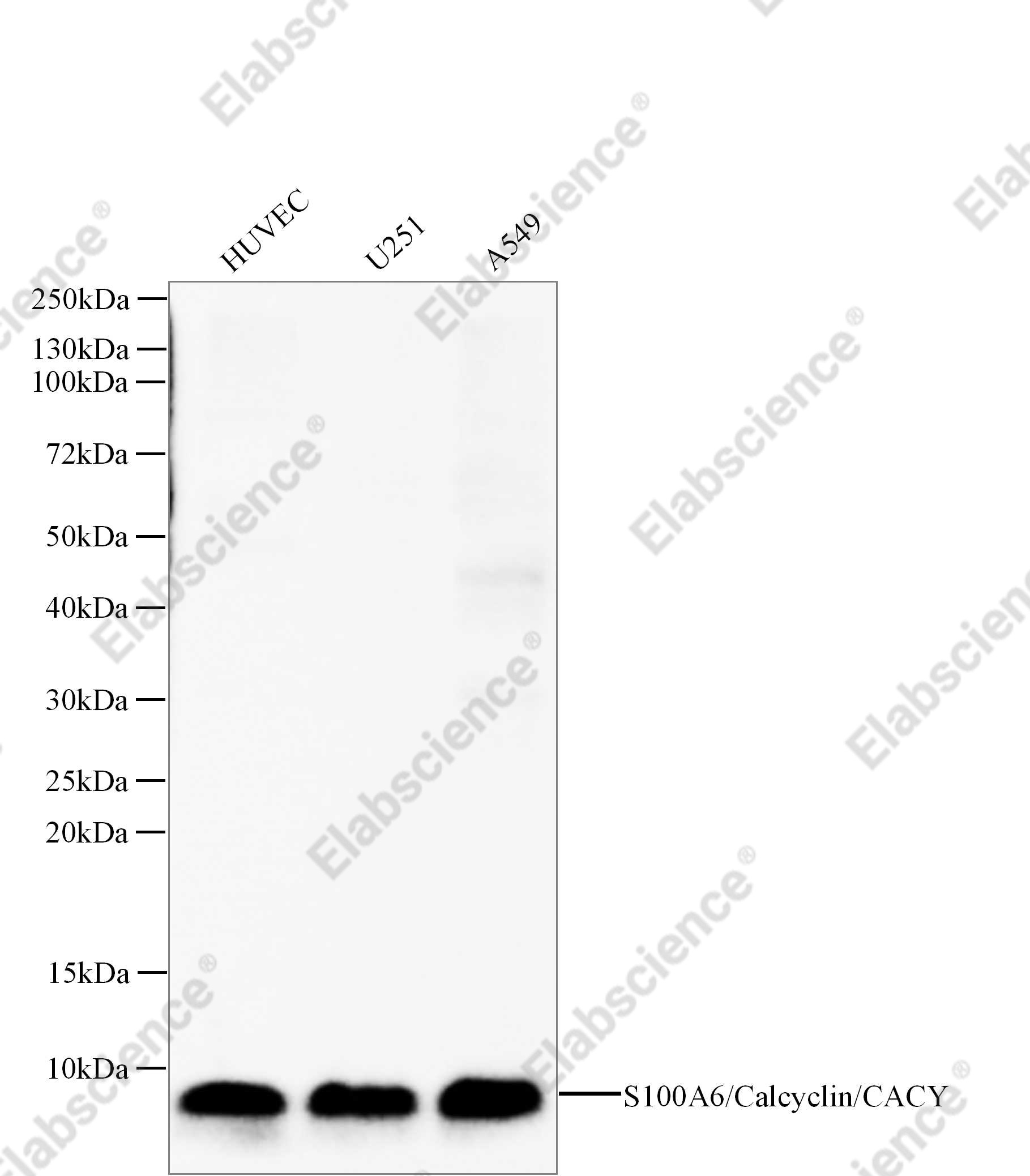 Recombinant S100A6/Calcyclin/CACY Monoclonal Antibody - 1